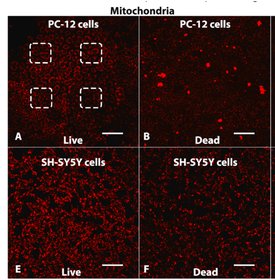Fluorescence images of live and dead PC-12 and SH-SY5Y cells with mitochondria